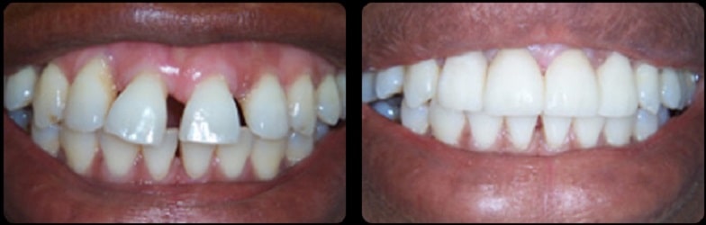 BEFORE & AFTER PICTURE GALLERY