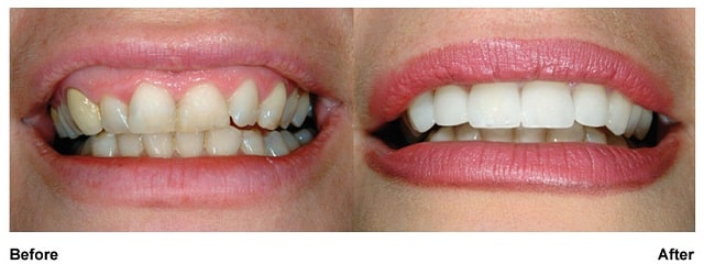 BEFORE & AFTER PICTURE GALLERY